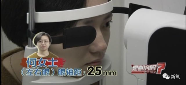 吴女士的近视度数为400度,带了15年眼镜,眼轴距为25.5mm.