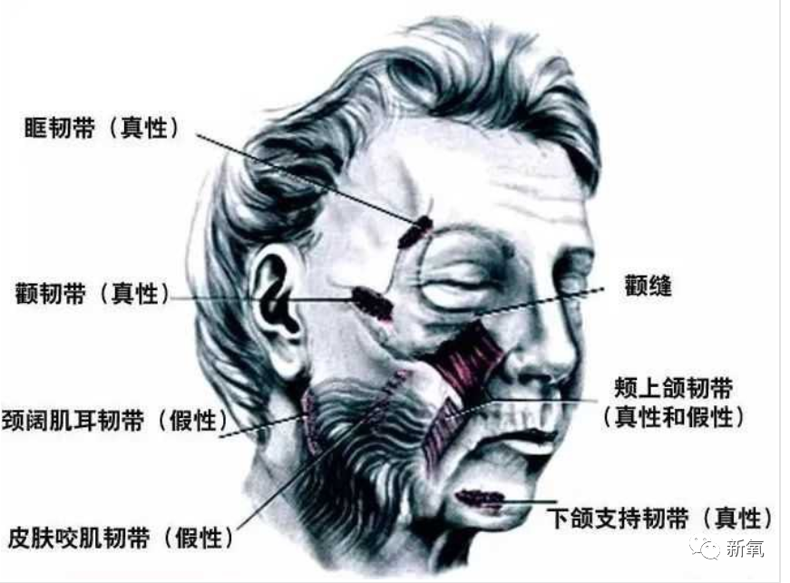 既然颧皮韧带是渔网的绳子,那么形成破颧纹的原因不外乎以下两种: 1