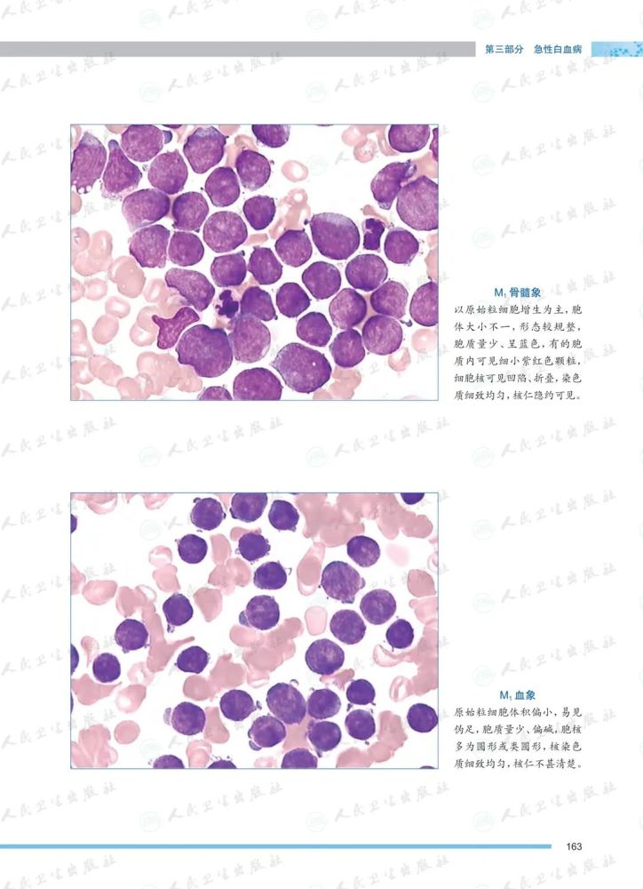 检验人必备图谱之《血液系统疾病血细胞形态学图谱》
