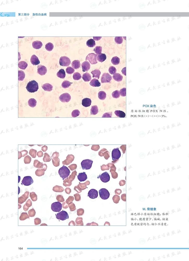检验人必备图谱之《血液系统疾病血细胞形态学图谱》