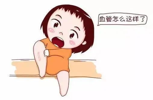 久坐不运动小心这类病——静脉血栓栓塞