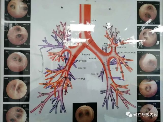 图2 我们可以看到整个支气管树逐级分支,越来越细,分支也越来越多