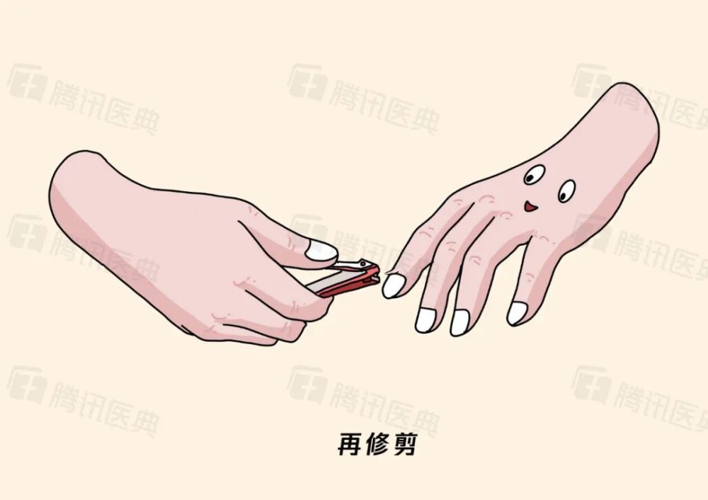 指甲经常长倒刺,不是因为缺维生素!3大原因很多人忽视