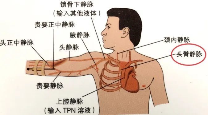 箭头所示 临床上大多以胸椎椎体作为影像学标志,t4为上腔静脉上段,t5