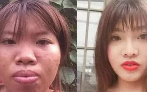 还记得那个为嫁豪门整容成功的越南丑女吗?刚生完女儿