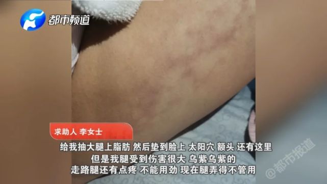 深信“旺夫秘方”，女子用奇招“糟蹋”身体，后果太惨了（视频/组图） - 4