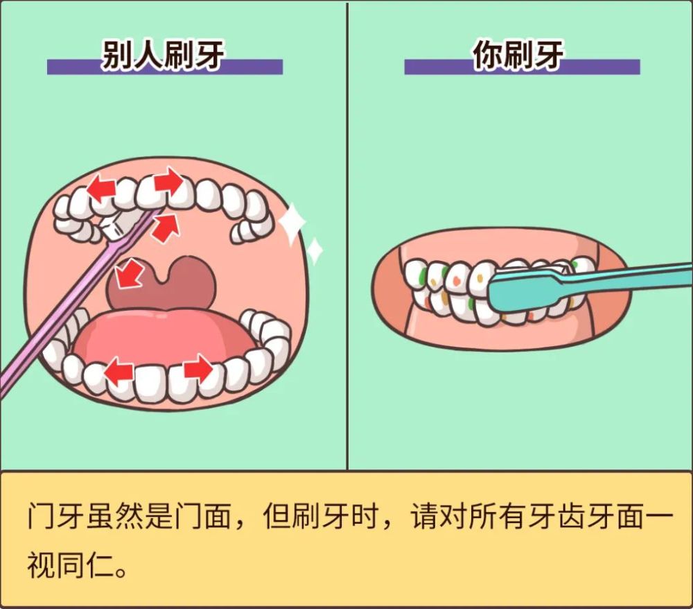 刷牙方式不正确,会导致各种口腔问题出现.