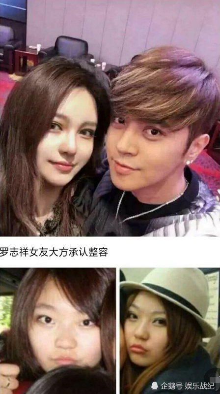 周扬青整容前旧照曝光,肥头大脸单眼皮,不敢相信是同一个人!