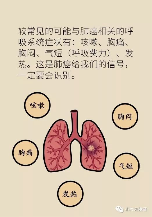 这不是感冒,可能是肿瘤!专家详解早期肺癌的八大信号