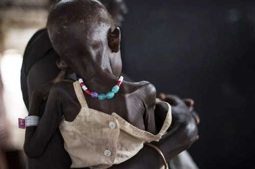 世界欠摄影师一句道歉:照片中饿得皮包骨的小女孩,活下来了吗?