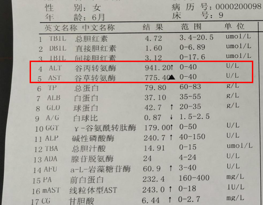 一例异常的肝功让我认识了川崎病