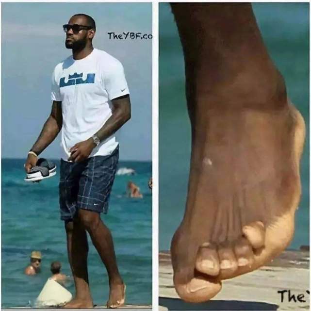 的鞋子,导致詹皇的脚趾完全变形,不过他的脚和大鲨鱼奥尼尔的脚比起来
