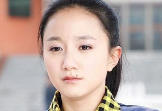 有痣和没痣差别在哪她曾将脸上的痣点掉看完网友比之前漂亮