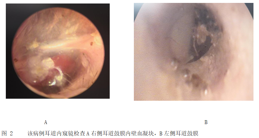 一例猫中耳炎病例的讨论分析