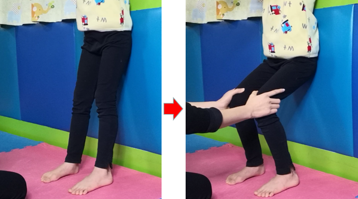 脑瘫儿童膝过伸运动治疗