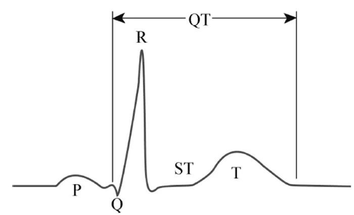 长QT 综合征,你了解多少?