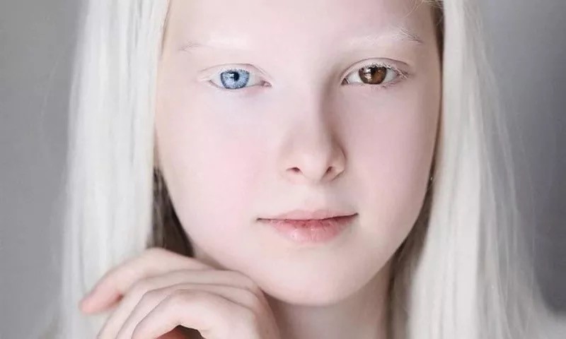 俄罗斯白化病瞳孔异色症少女照片惊艳网络,网友称她的
