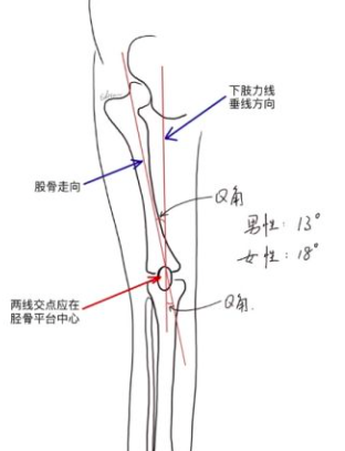 如何自我矫正O型腿？每天只花10分钟，轻松告别罗圈腿