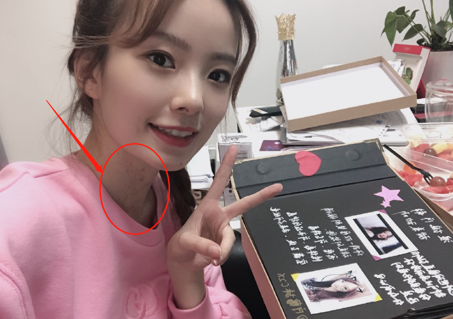 陈卓璇无美颜无滤镜下原来长这样,有谁注意她的脖子?原来是胎记