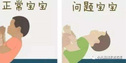 孩子打挺头后仰就是脑瘫吗脑瘫的治疗方法