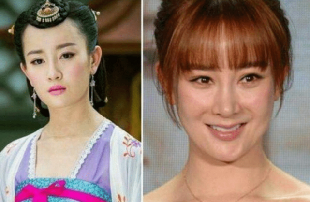 整容失败的五位女星,第一个成"反面教材"-最后一个真