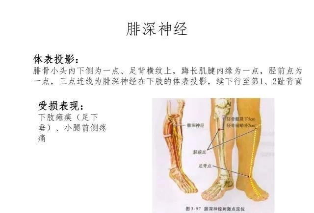 周围神经体表投影和肌肉刺激点