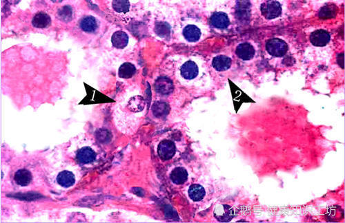 箭头2所指为甲状腺滤泡上皮细胞,箭头1所指为滤泡旁细胞