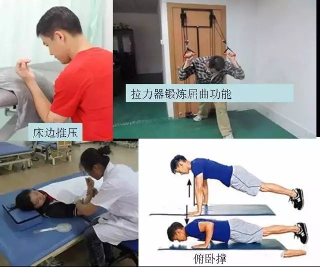 2.肘关节伸直功能锻炼
