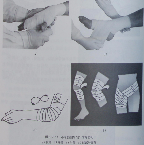 5)手臂的悬吊适用范围:手臂的悬吊适用于手臂或肘部等骨折后的包扎.