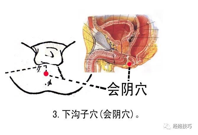 蠡沟穴治阴痒,阴痛(湿热下注型;配归来穴,百会穴治阴挺(中气下陷型)