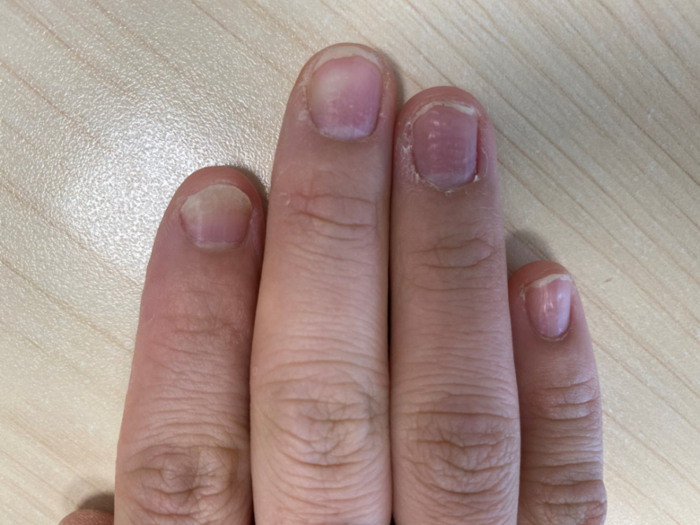 对指甲来说,甲小皮是保护指甲和皮肤相连的地方,它可以保护指甲.