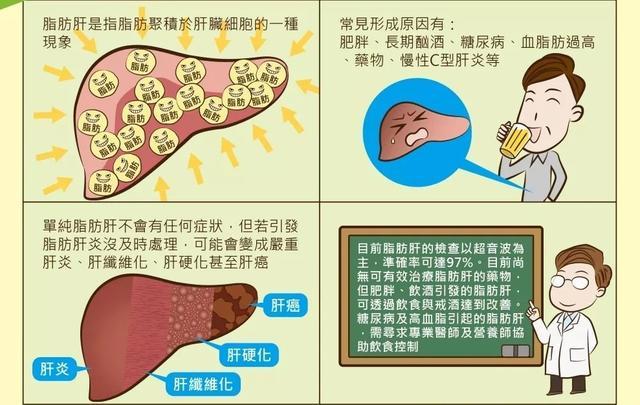 难道脂肪肝只是胖子的专利吗？1058万人的研究给出了答案