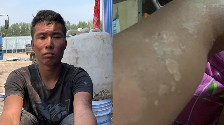 00后美女未婚生子突患血癌男友卖房搭救：孩子不能和我一样单亲