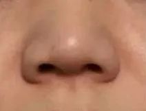 怀孕鼻子会变大？