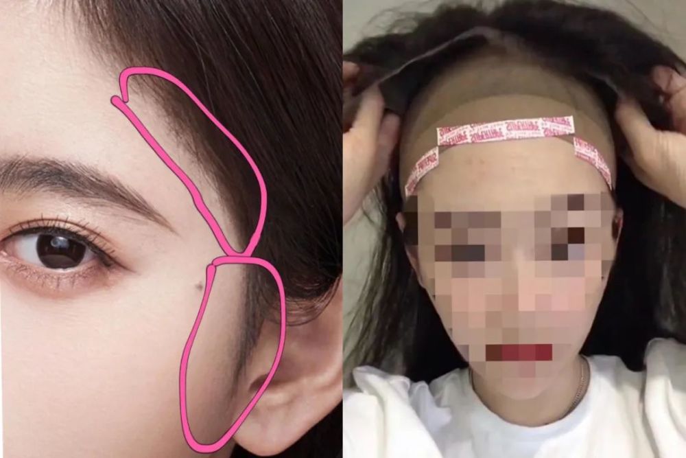 变美模板鞠婧祎就连头皮也是假的？为了美她可真狠呐！