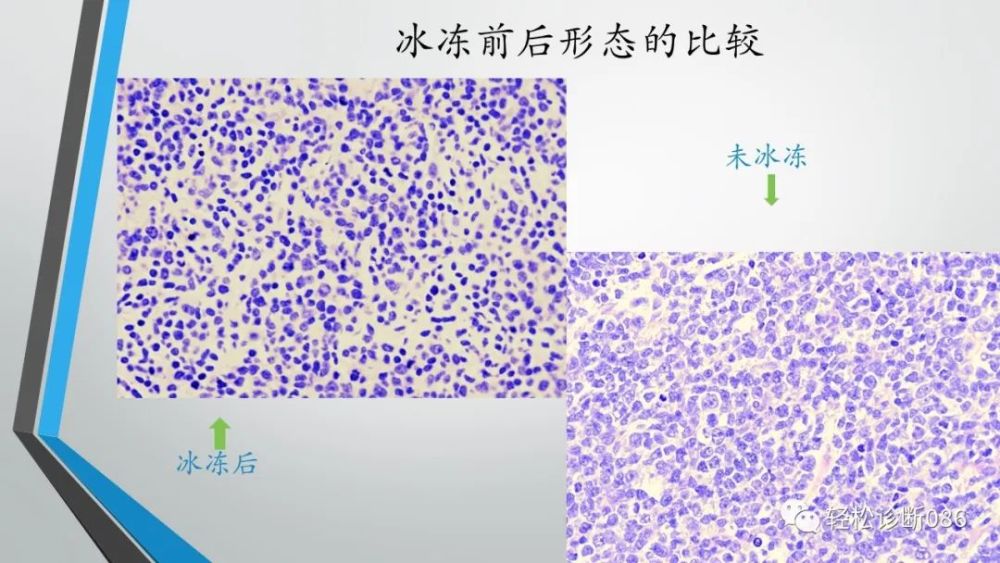 淋巴结he切片的规范化制作