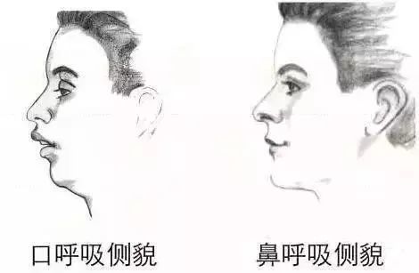 为啥有人越长越好看，有人越长越丑？医生：这些动作让人变丑！