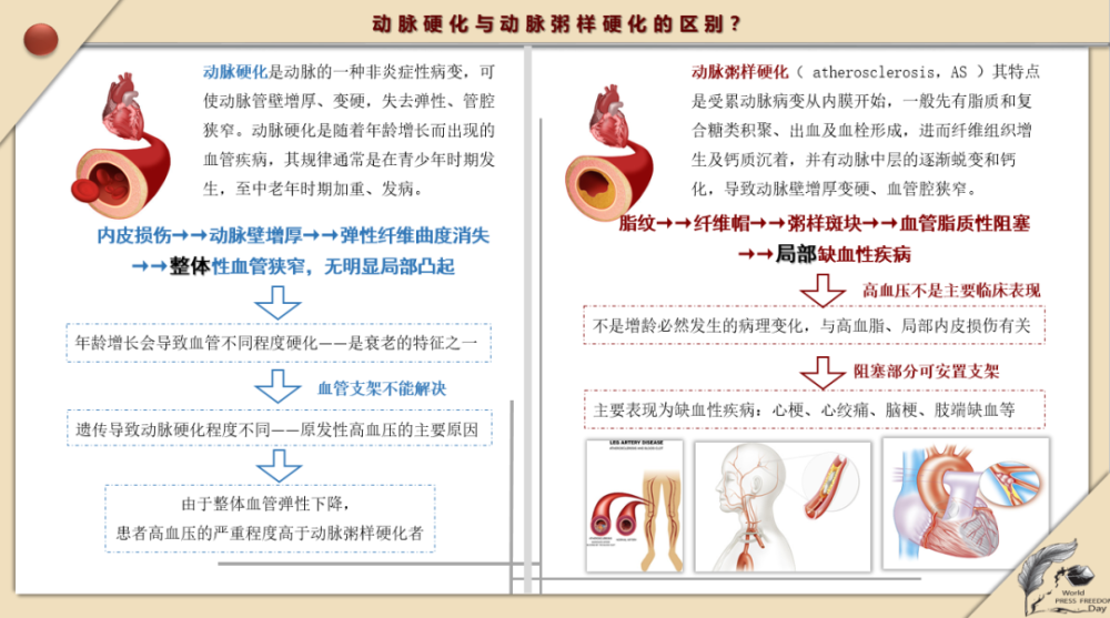 你必须要知道的知识:动脉硬化不是动脉粥样硬化