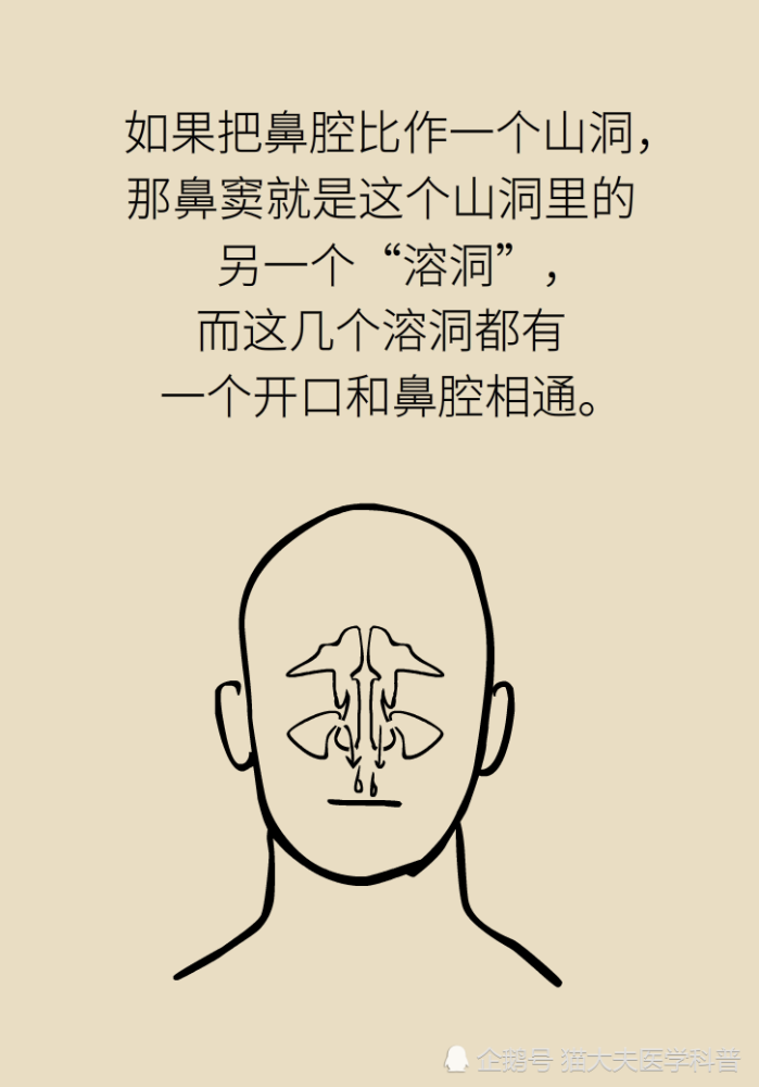 为什么鼻窦发炎，疼的却是头、眼和牙？
