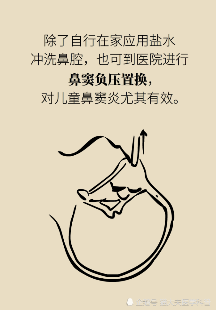 为什么鼻窦发炎，疼的却是头、眼和牙？
