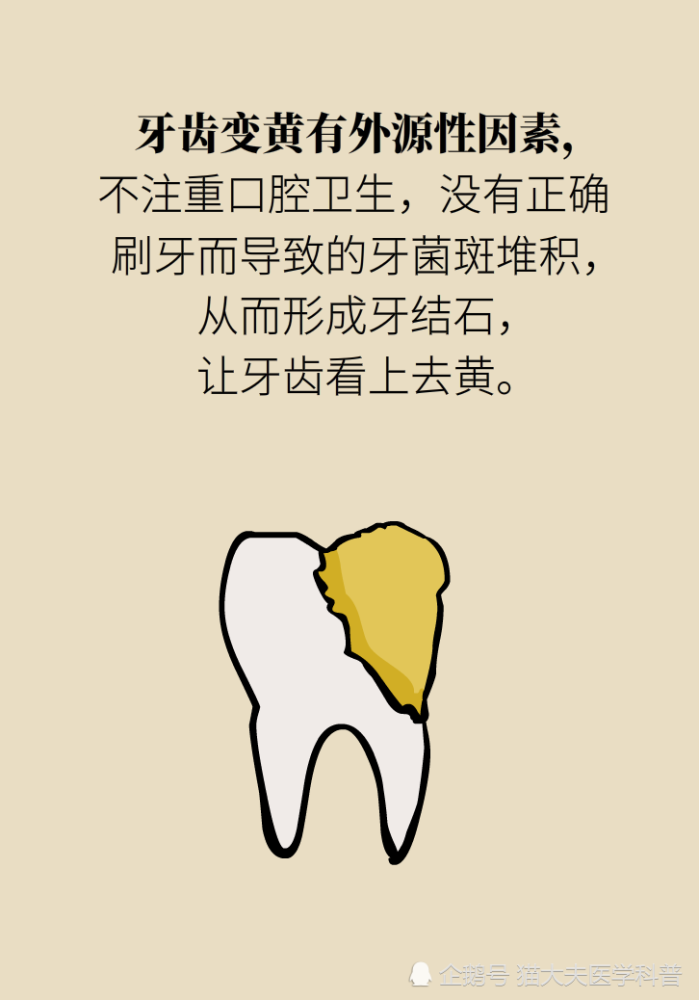 牙太黄，这些“美白”方法管用吗？
