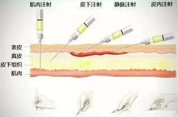 乙肝在研新药gc1102,单次或多次静脉注射,表面抗原消失率超10%