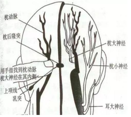 颈椎横突骨的后方, 2)颈椎正中及外方的斜方肌,半棘肌位置; 3)枕骨后