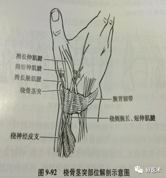 手部疼痛僵硬弹响不灵活腱鞘炎的病症一次说清