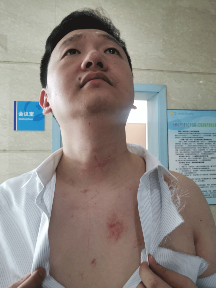 32%的安华企管委派代表)胸前出现多处抓痕和淤青,上身衬衫被撕破,且粘