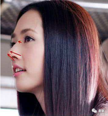 好好的奶茶妹妹2.0，为什么非要乱do鼻子整瞎了啊！