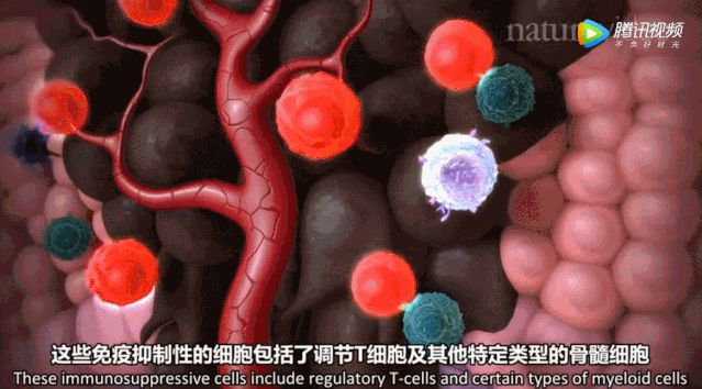 人体免疫细胞是如何一步步消灭癌细胞呢