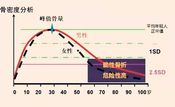 男性50岁后,钙吸收能力衰退,骨密度,骨质量就会大幅降低,骨质疏松性