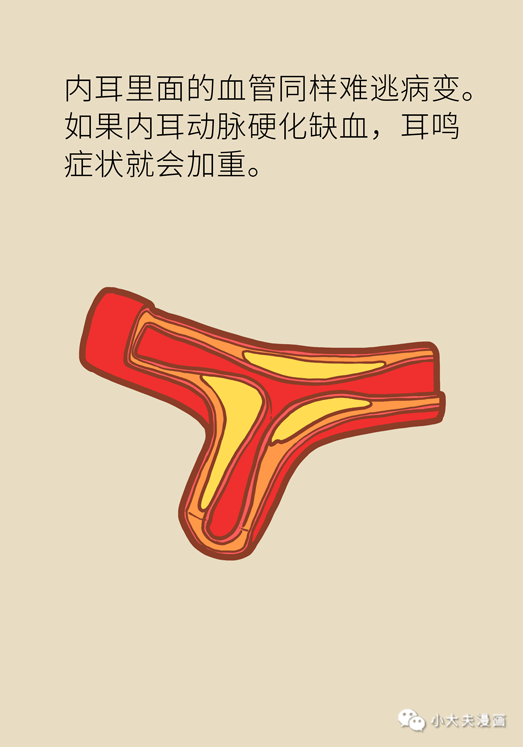 耳鸣还和血管有关？这两种表现可能是大病征兆！