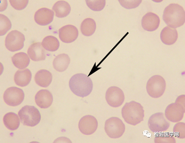 外周血细胞形态学室间质评合辑—红细胞